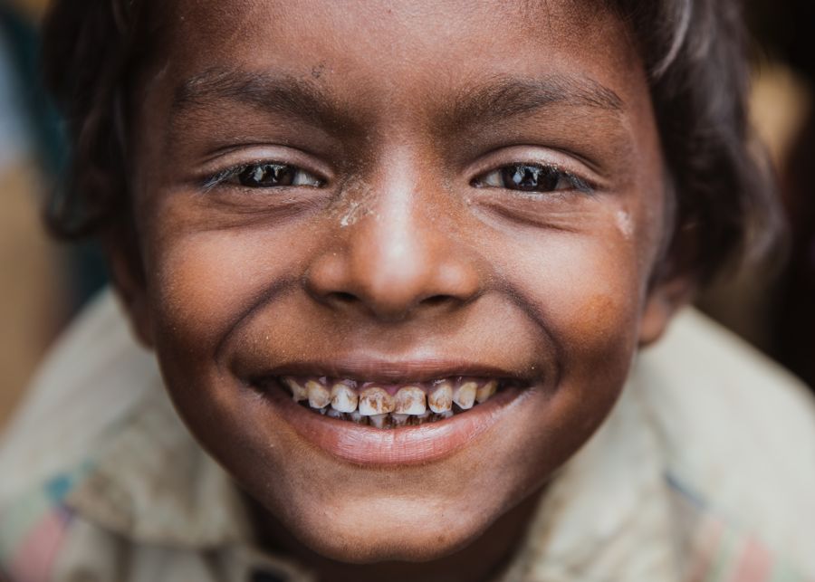 Portrait of a Boy, Kutupalong Refugee Camp, Bangladesh: close portrait of a boy with a wide smile looking into the camera. Photograph by Marcus Vallance.